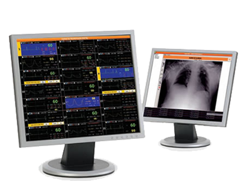A Central de Monitorização Philips da Dixtal é um sistema de monitoramento poderoso - em tempo real - que oferece ao seu hospital um acesso fácil às informações, principalmente em momentos em que é necessário decisões médicas importantes. 